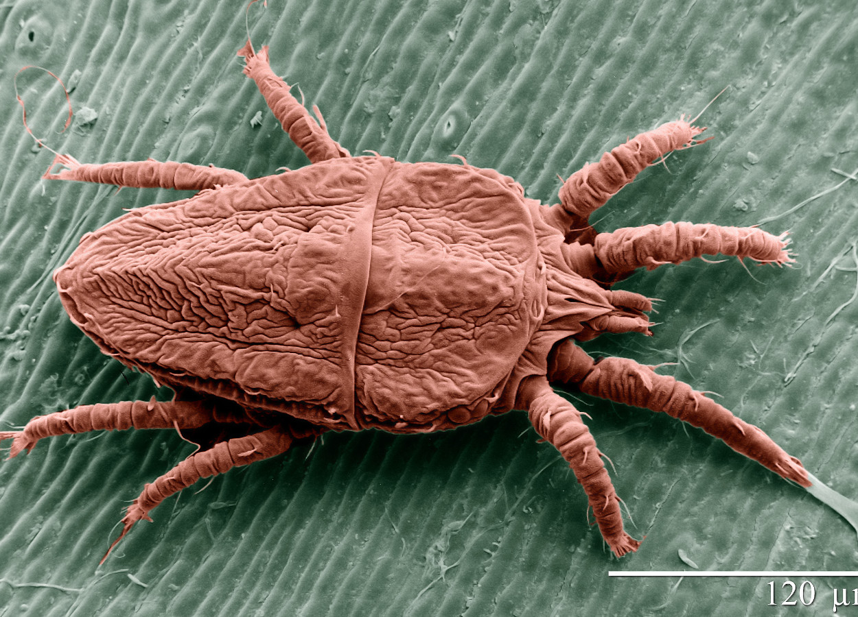 Leprosis CiLV